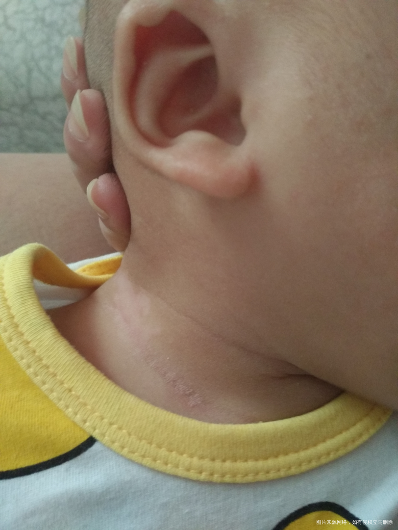 麻烦经过的医生看一下,帮我解答下,谢谢!!