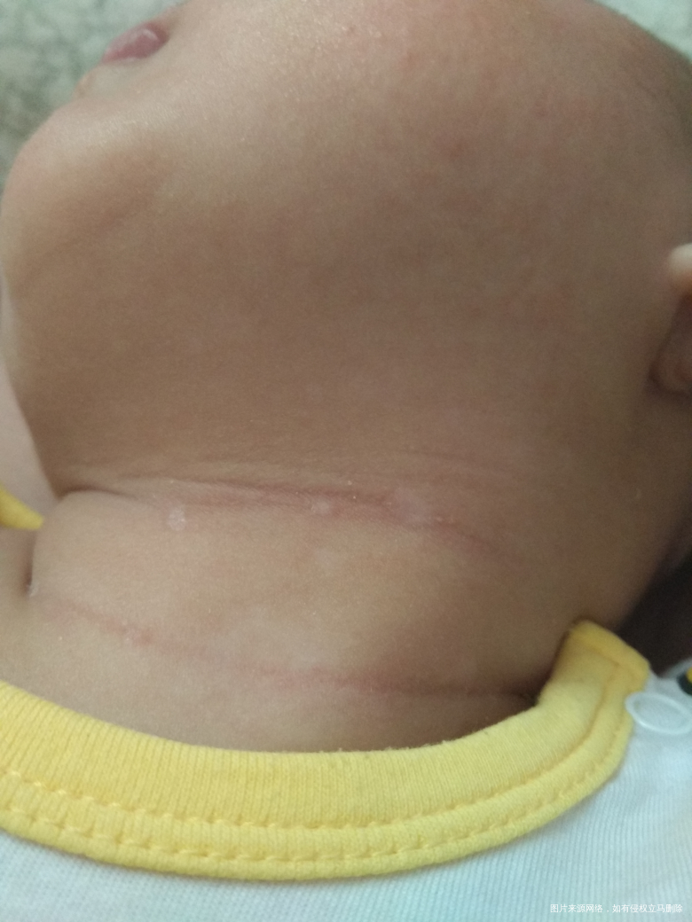 麻烦经过的医生看一下,帮我解答下,谢谢!!