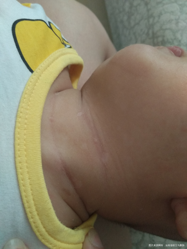 麻烦经过的医生看一下,帮我解答下,谢谢!!