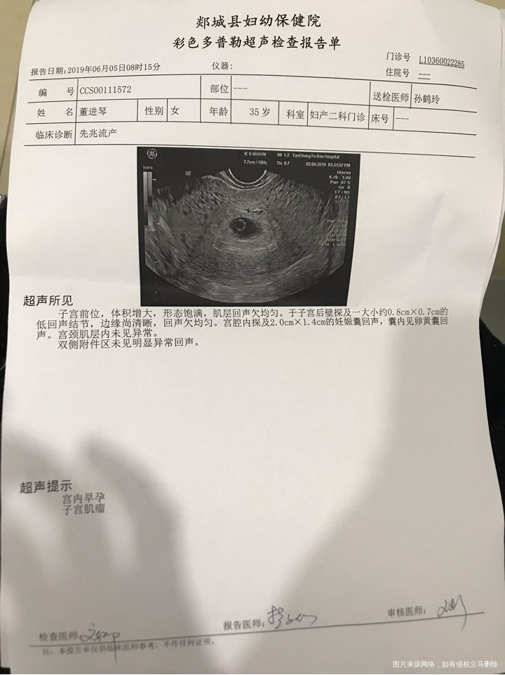 孕7周➕2,今天B超还没有胎芽胎心