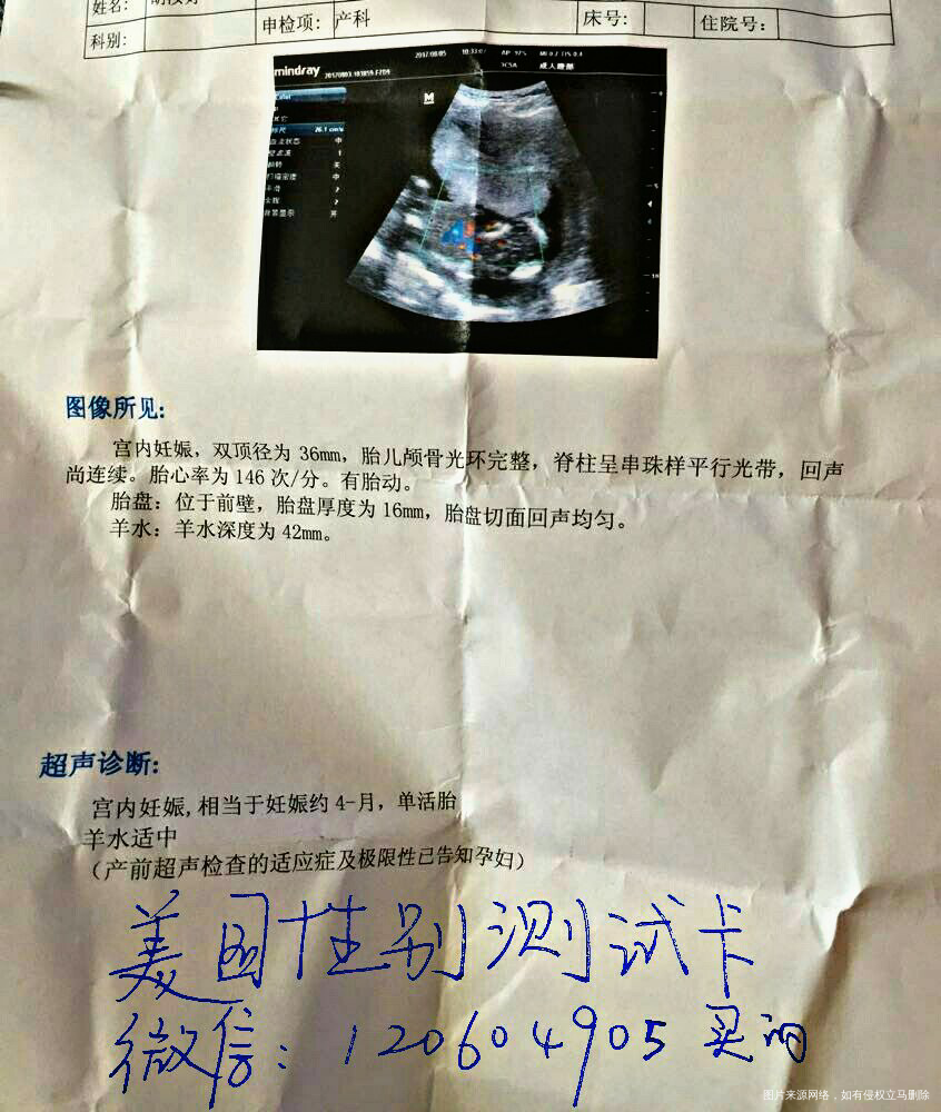 二胎儿女双全,传健康男宝宝。