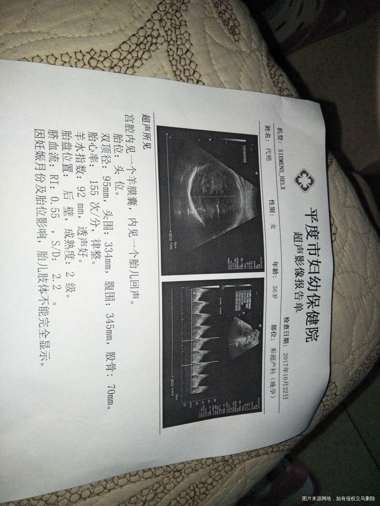 大夫麻烦给看看孩子大小,多少斤