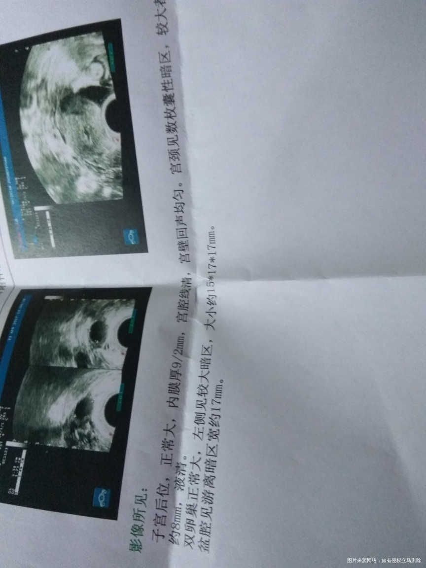 我的卵泡有多少大了 忘了问