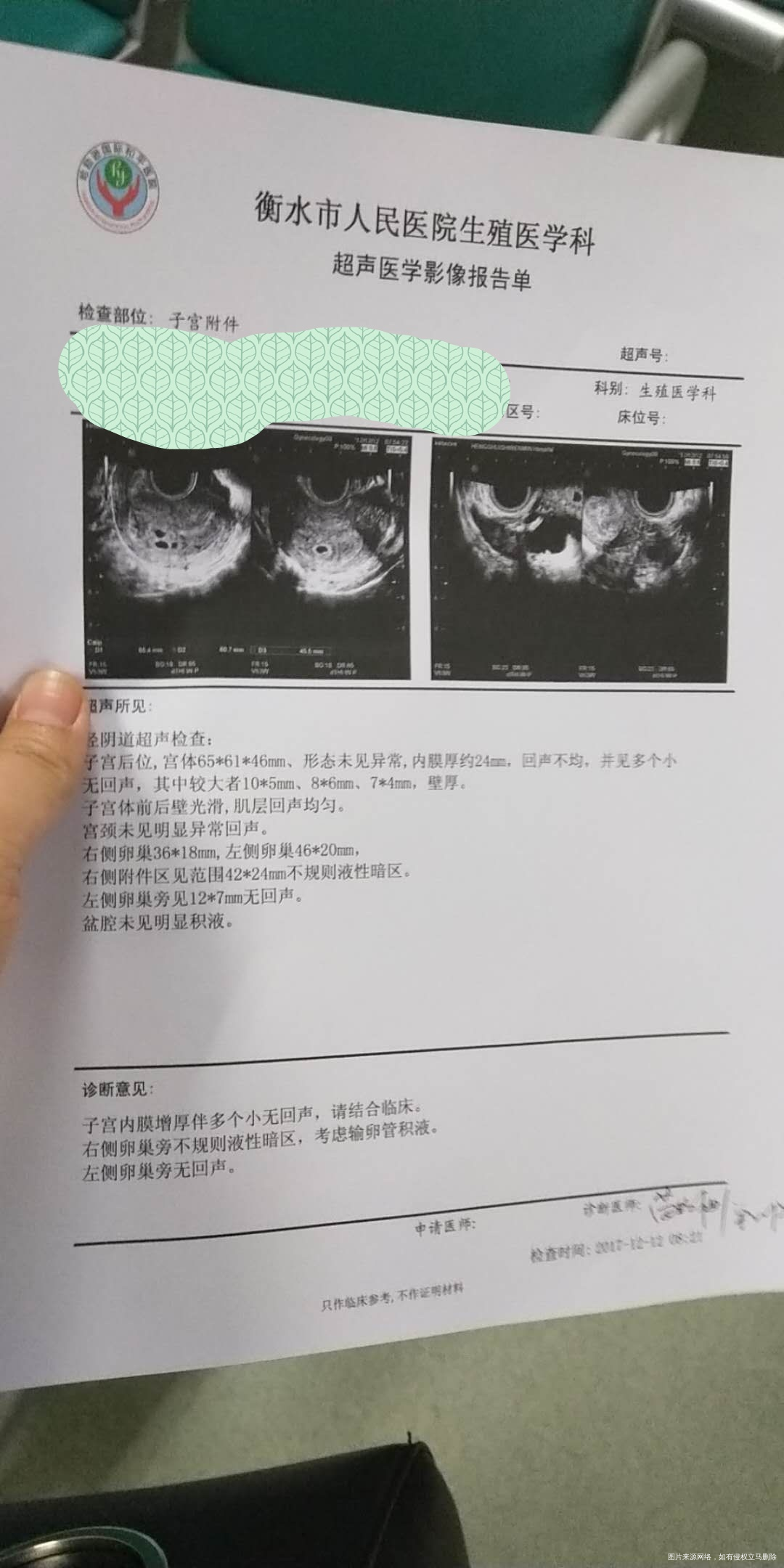 两个冻囊胚分裂多个,而且空囊,希望还有多少?
