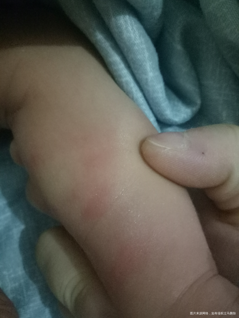 有没有在线的医生,看看怎么回事这是