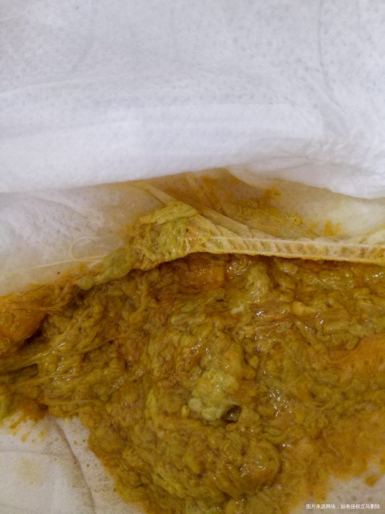 六个月孩子拉出来这样正常吗?