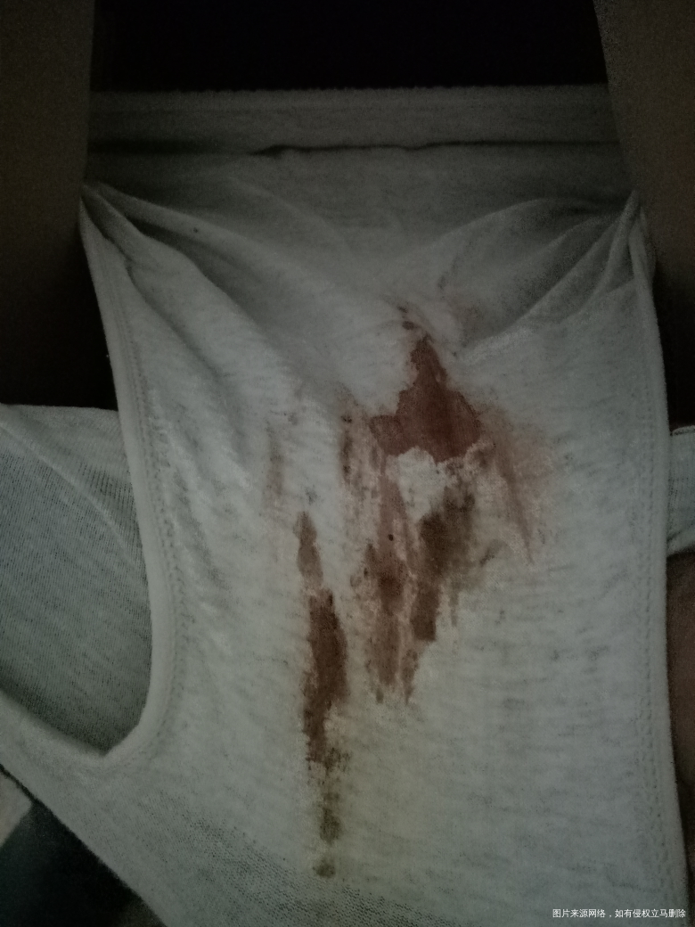 经期第十六出血,请医生帮我解答