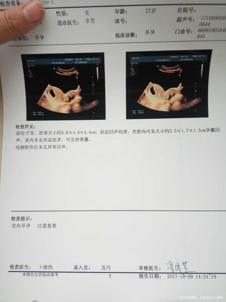 求助大夫了帮忙看下检查结果