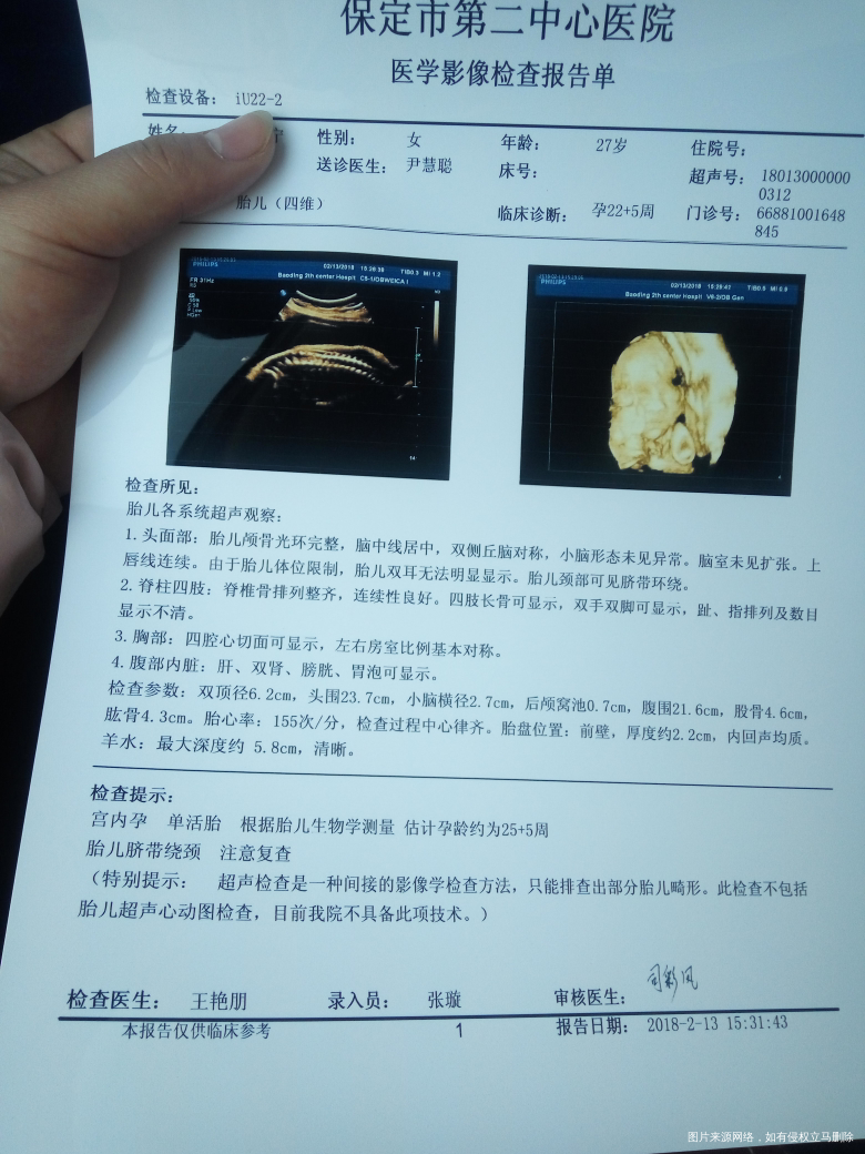 麻烦大夫帮忙看看彩超结果