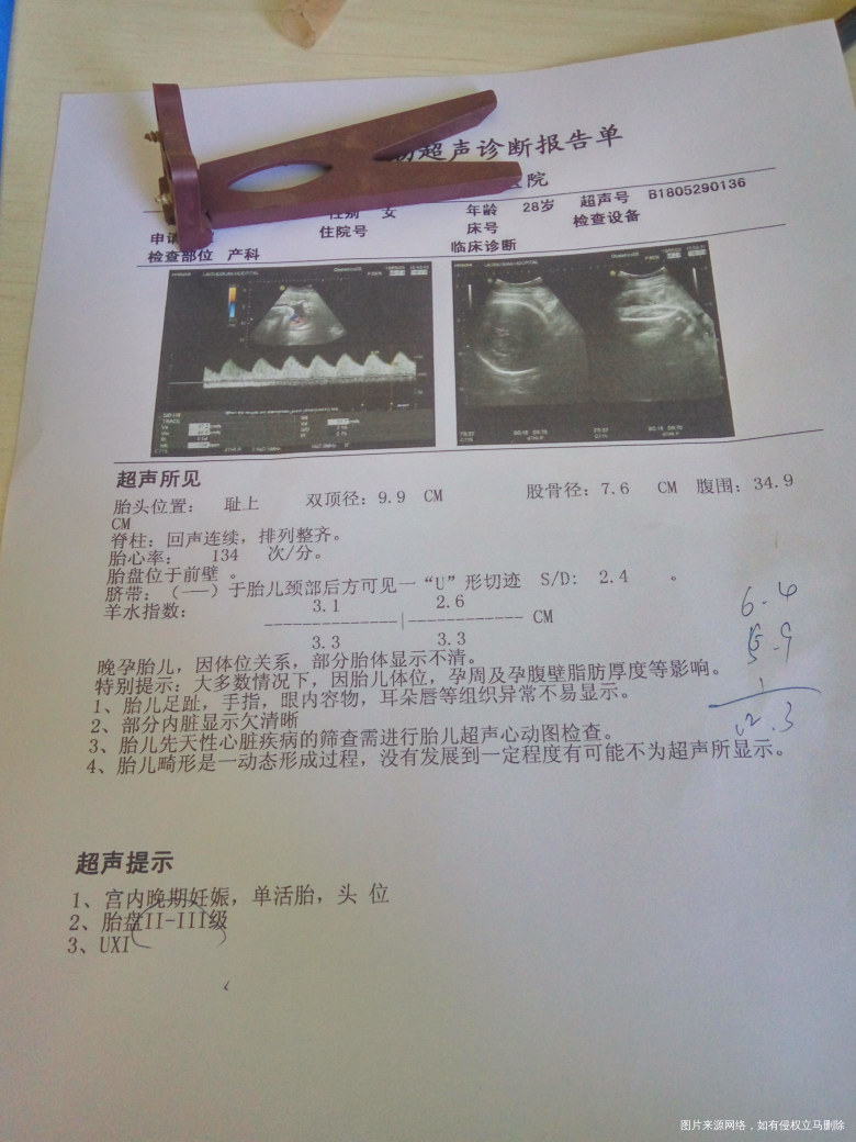求助大夫帮我看看彩超单子