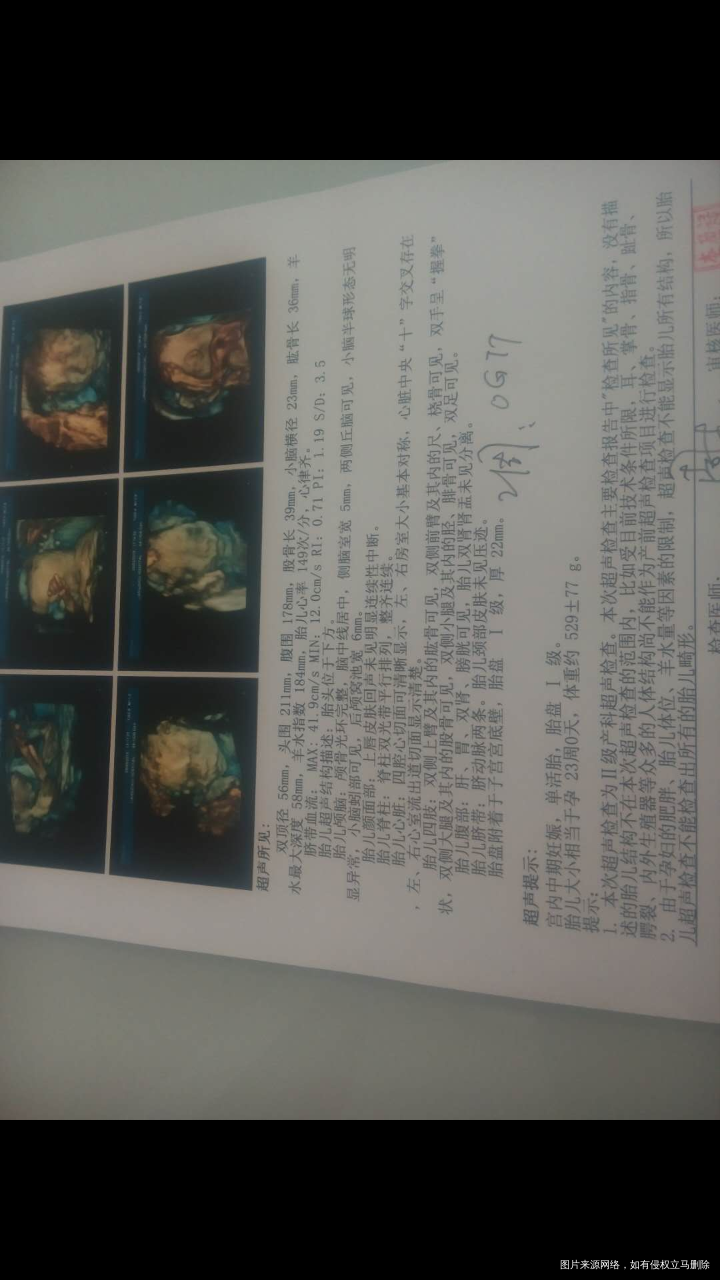 医生帮我看看四维结果正常不,现在胎儿多大