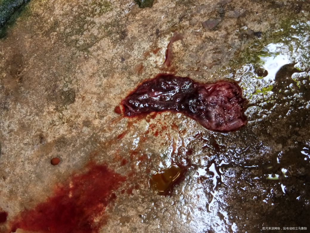 请帮我看看 是种什么情况