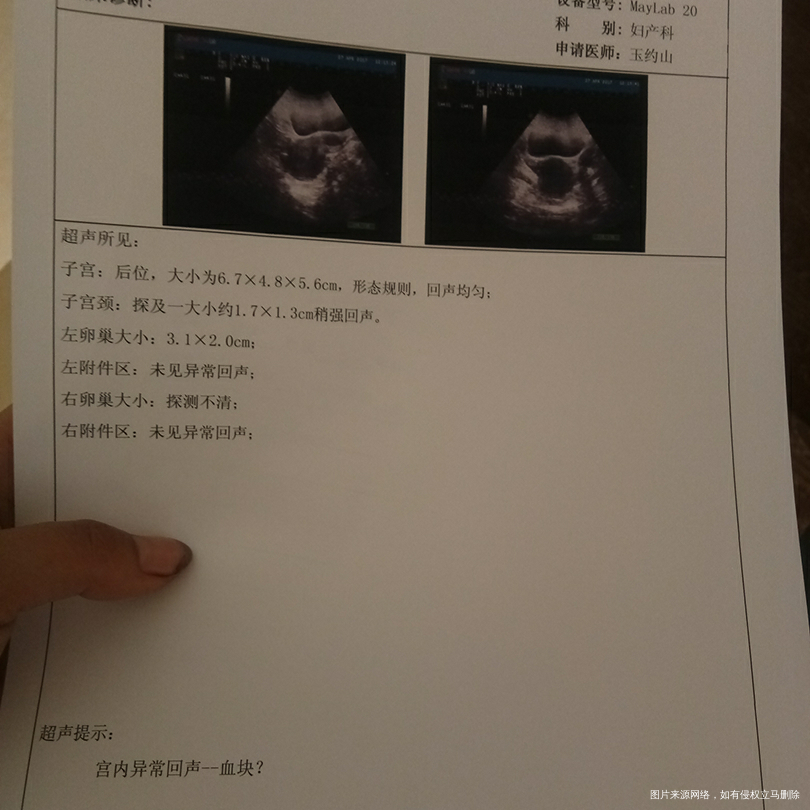 请帮我看看 是种什么情况