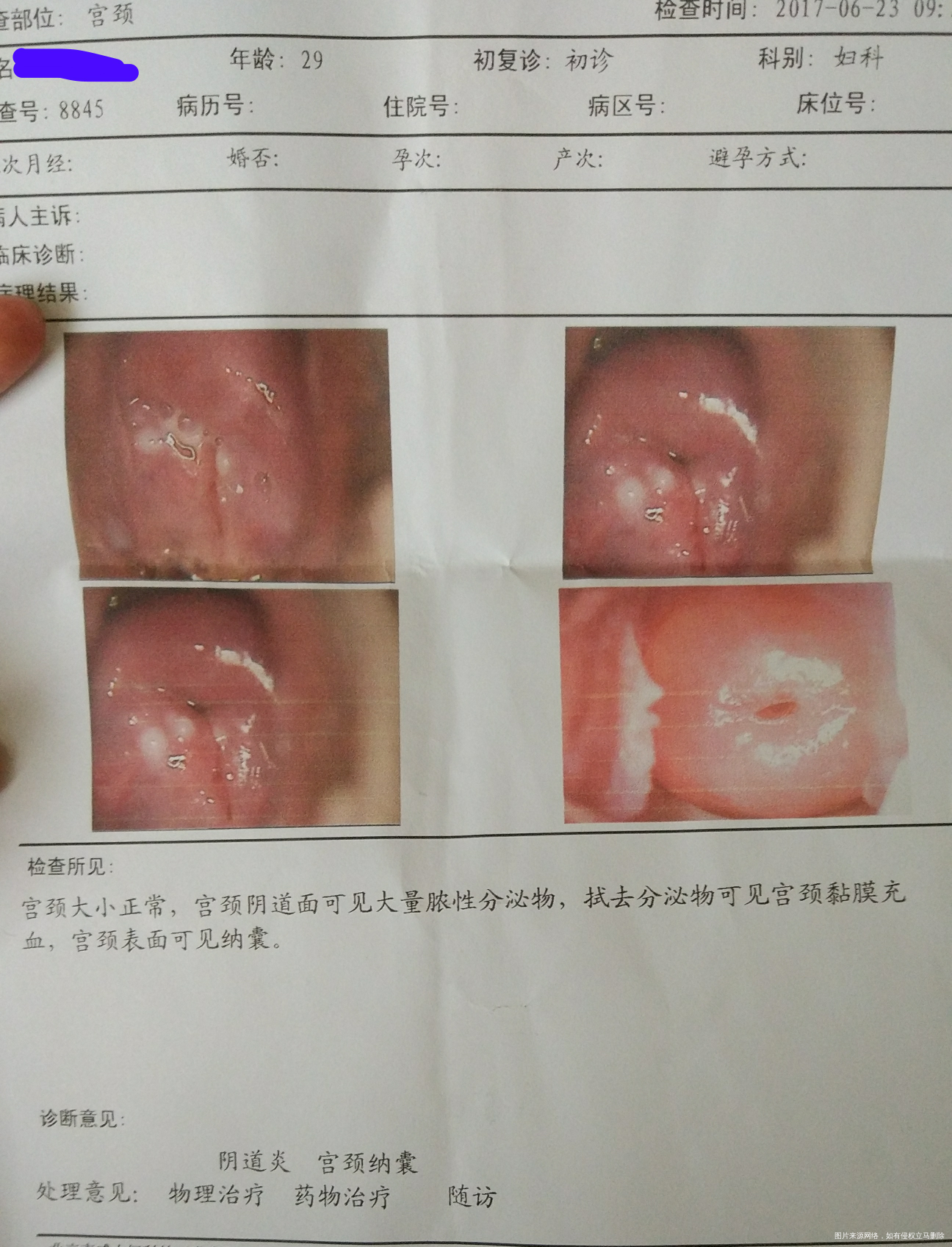 哺乳期怎么治疗,这到底是怎么了?