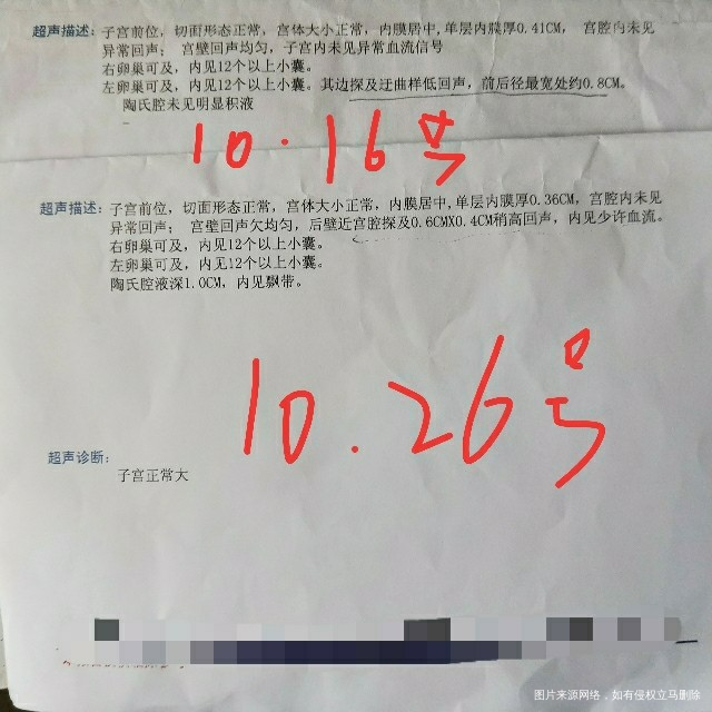 月经第五天检查单,帮我看看哪里不好的