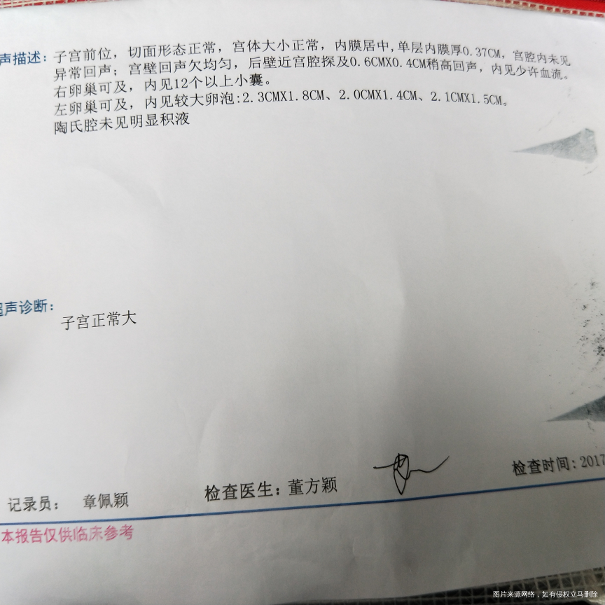 您好,麻烦医生帮我看看什么时候可以排卵,谢谢