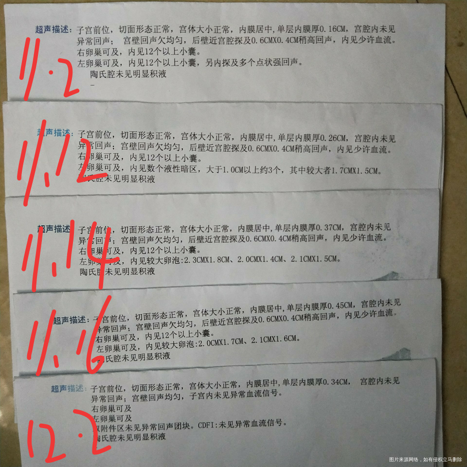多囊是不是没有了,今天刻下来月经第一天