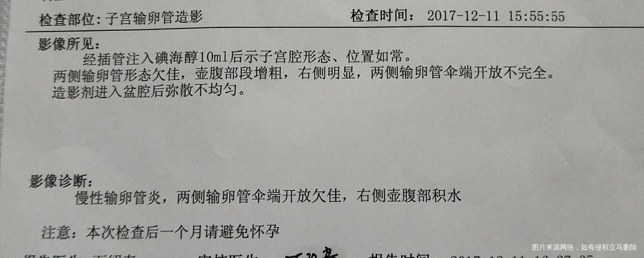 急急急,造影后5天阴道痒😭😭