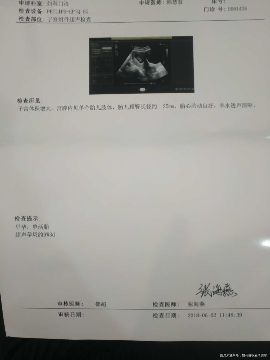 我怀啦 | 终于等到你 愿我宝顺顺利利过这十个月