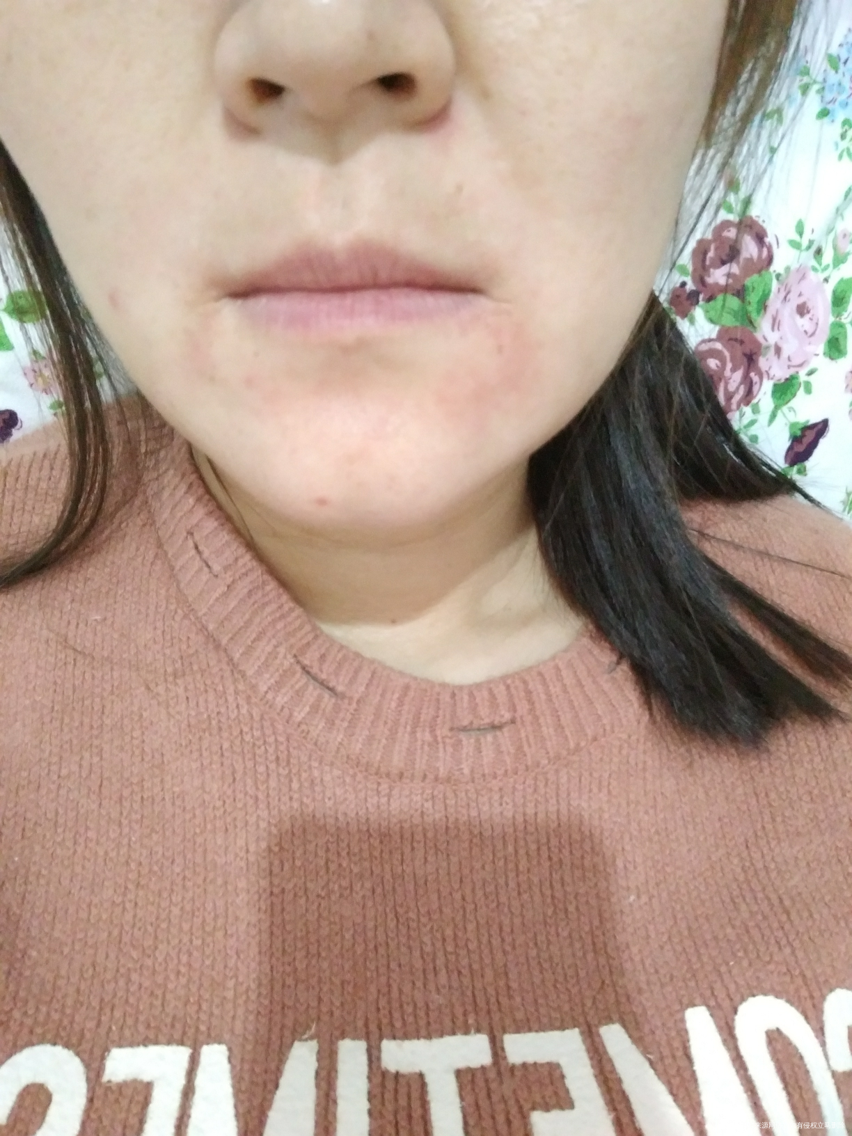 都一个月了还是这样 好烦