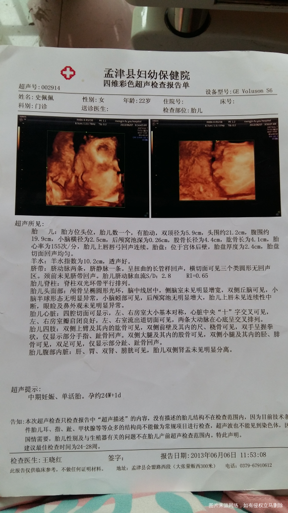 【二胎宝妈】两份四维,男女宝宝对比