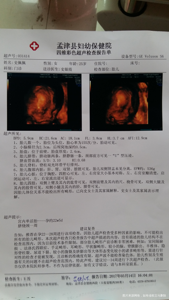 【二胎宝妈】两份四维,男女宝宝对比