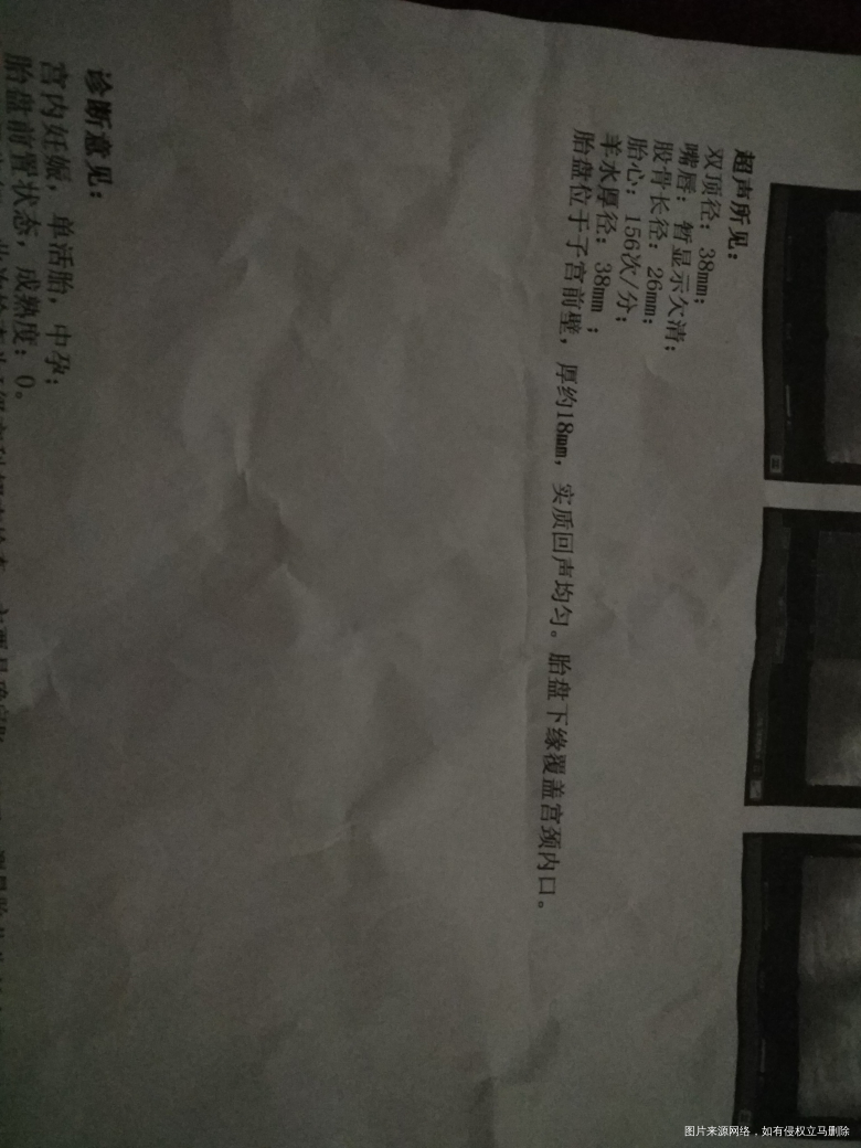 生完第一胎五个月后怀上二胎!现在16+周胎盘低好怕