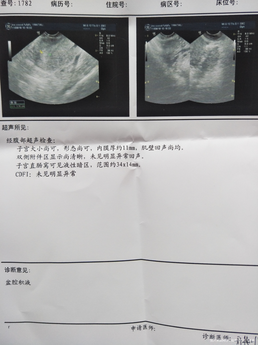 因为哺乳期不能吃药!麻烦大夫帮我看看!