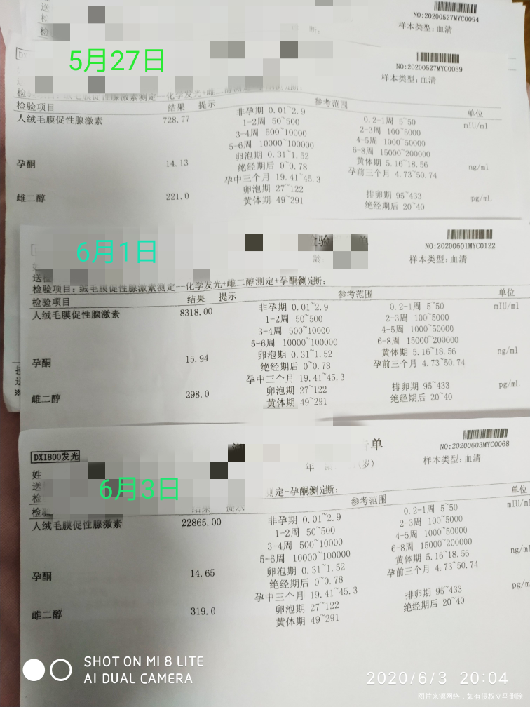 孕酮下降,彩超没看到明显孕囊