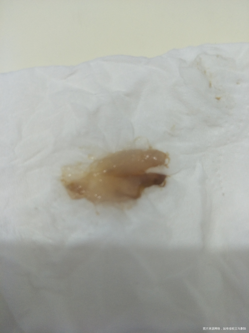 求助医生帮我看看这是啥