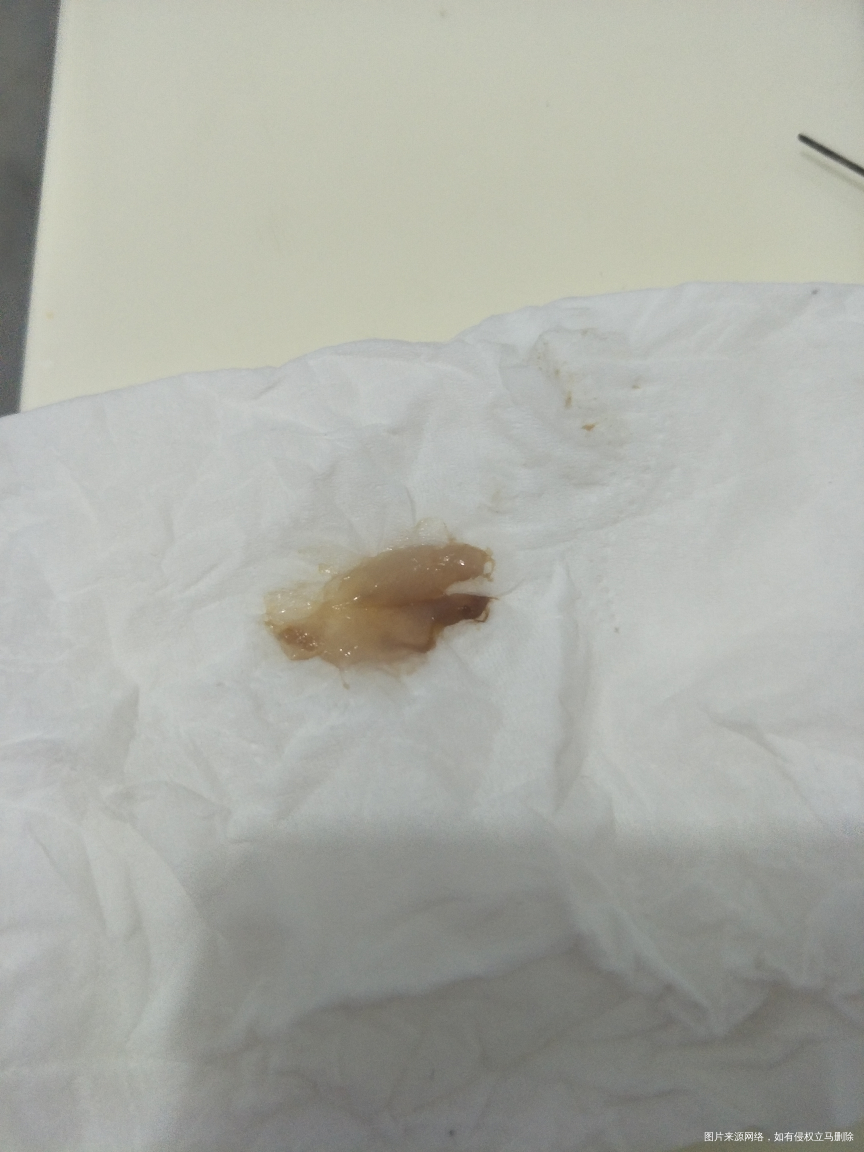 求助医生帮我看看这是啥