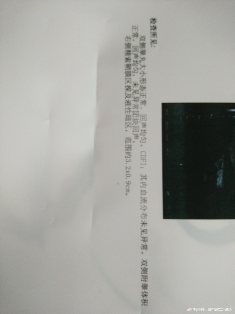 宝宝10个月右侧鞘膜积液