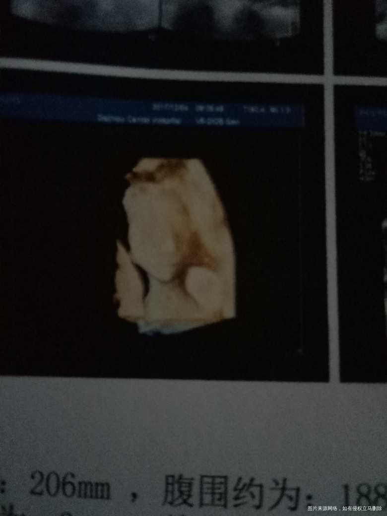 今天做了四维彩超,小朋友很乖,还挺听话的