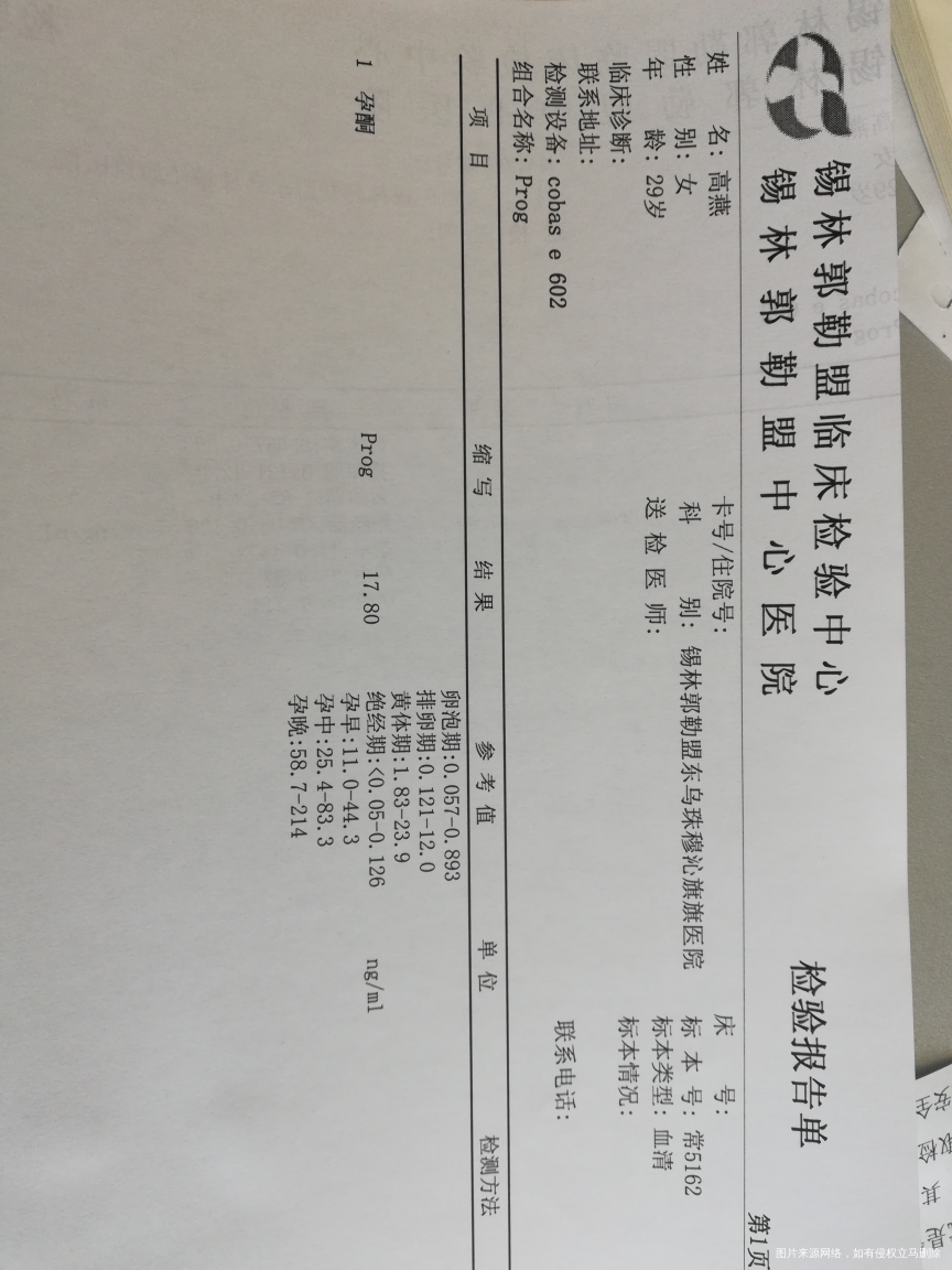 怀孕5周hcg280 孕酮14.3