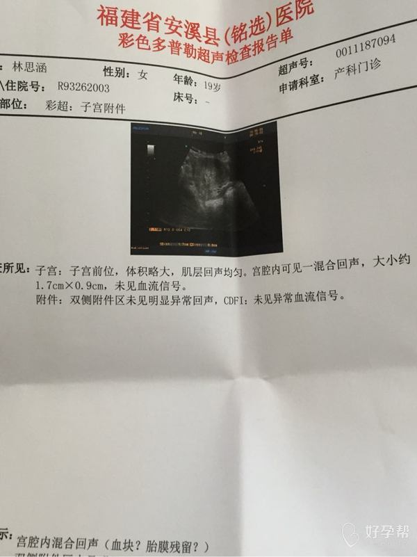 这彩超单算是流产了吗