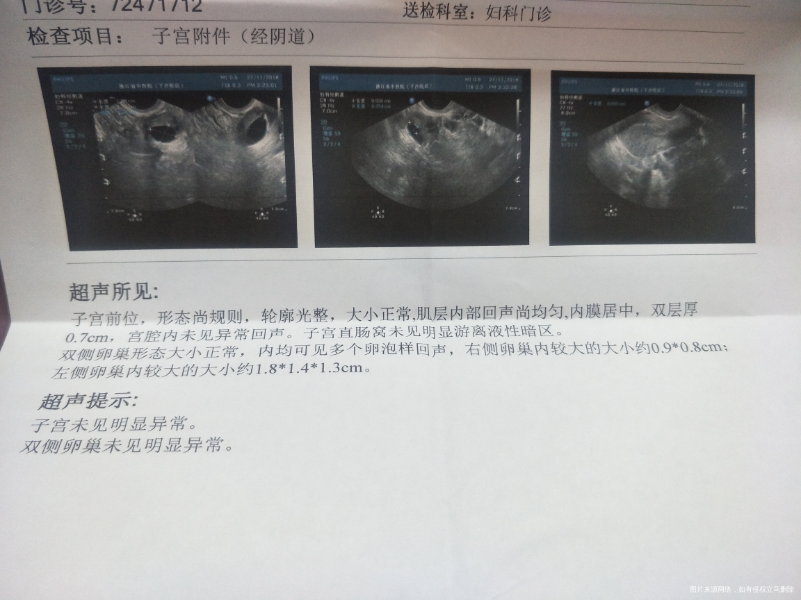 监测卵泡,接下来,怎么办,跪求……