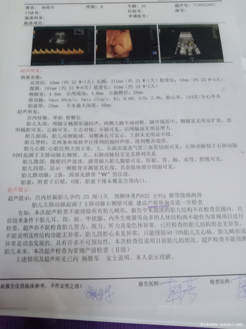 四维彩超这种情况严重吗