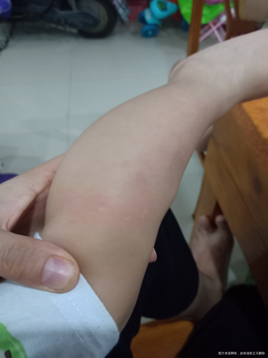 有没有遇到这种情况,宝宝一岁半了