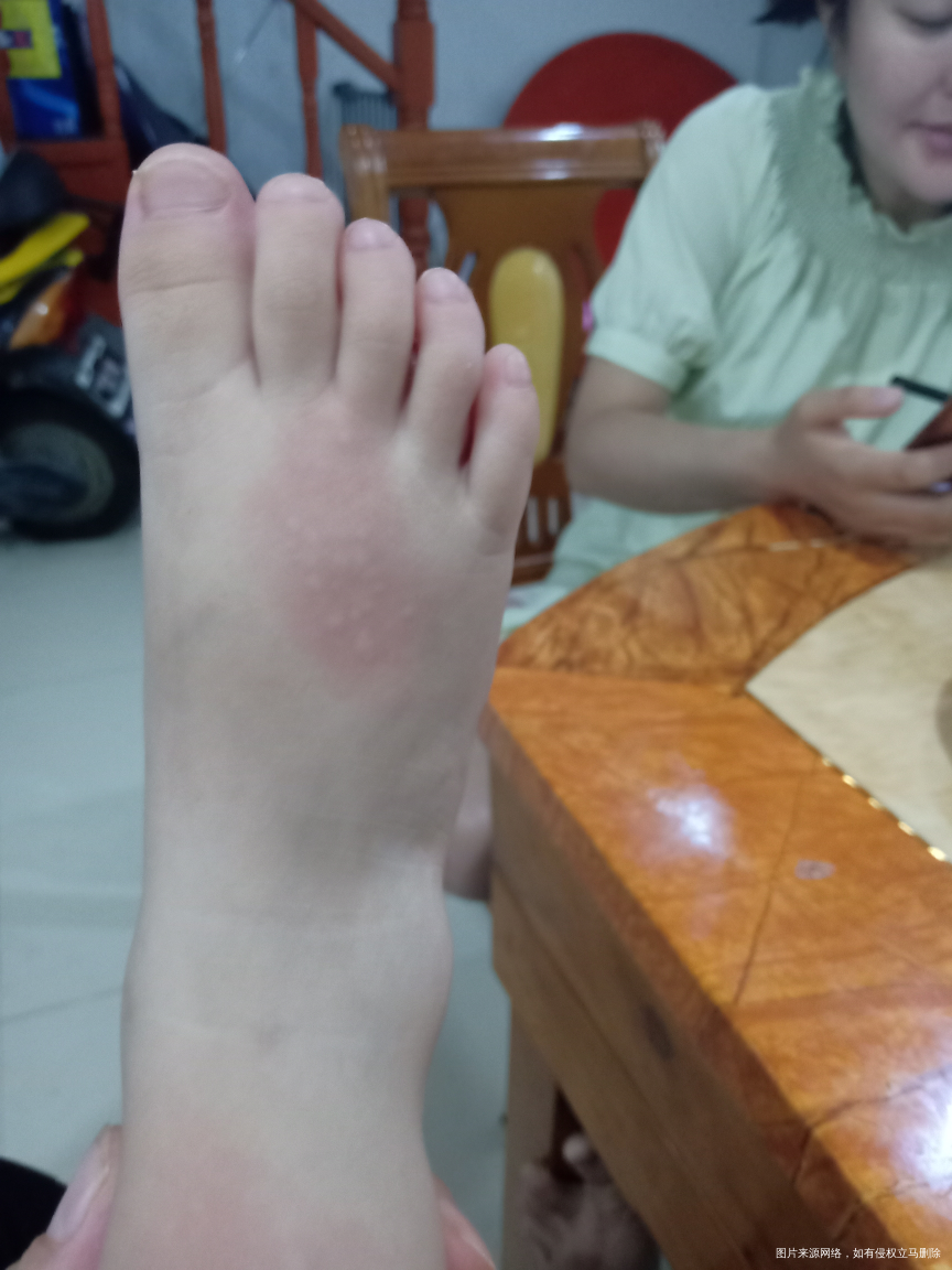 有没有遇到这种情况,宝宝一岁半了