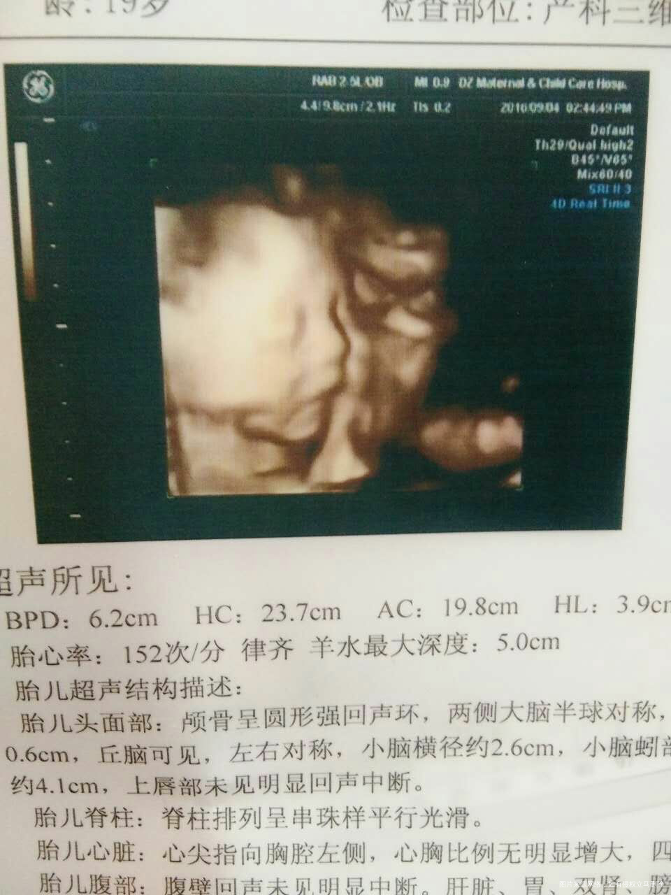 【孕期分享】之分享给姐妹们我怀孕的整个过程