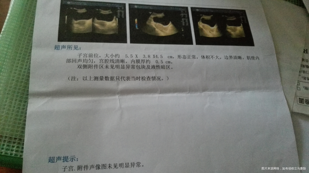 医生麻烦帮我看看这是流干净了吗?