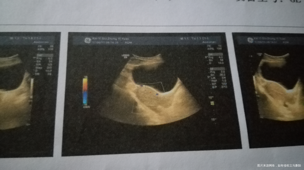医生麻烦帮我看看这是流干净了吗?