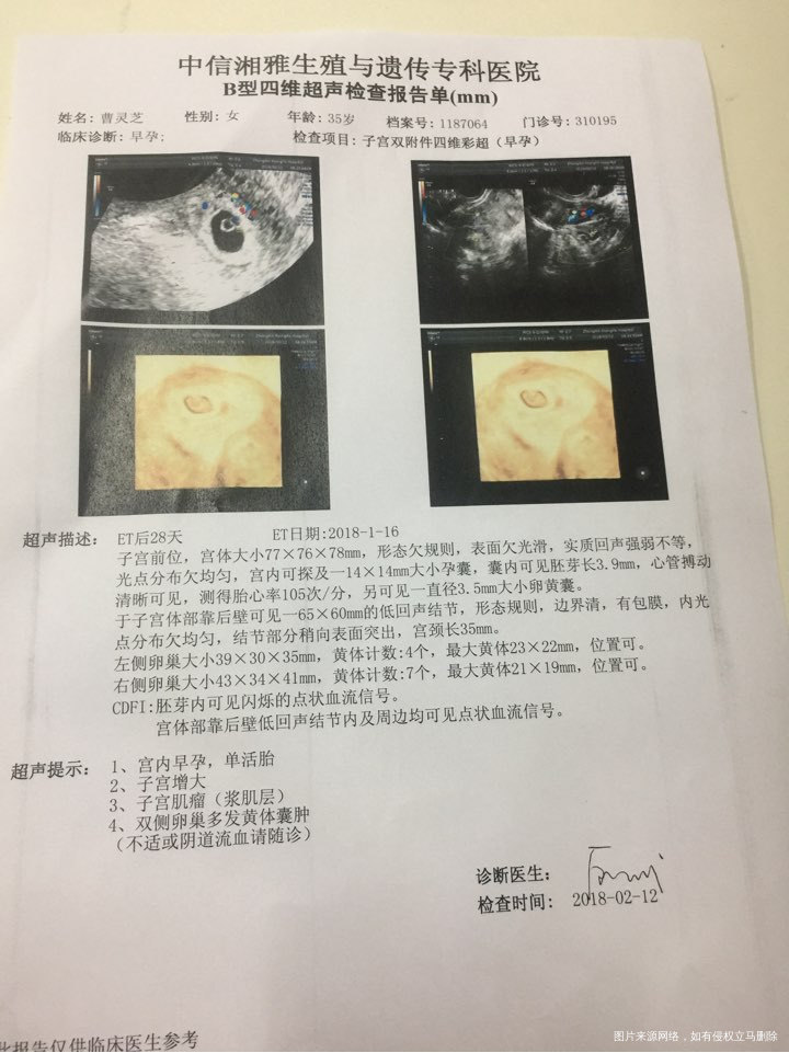 
移植后第二十八B超!也是和宝宝第一次见面、宝宝现在在妈妈肚子里还是一个很小很小…