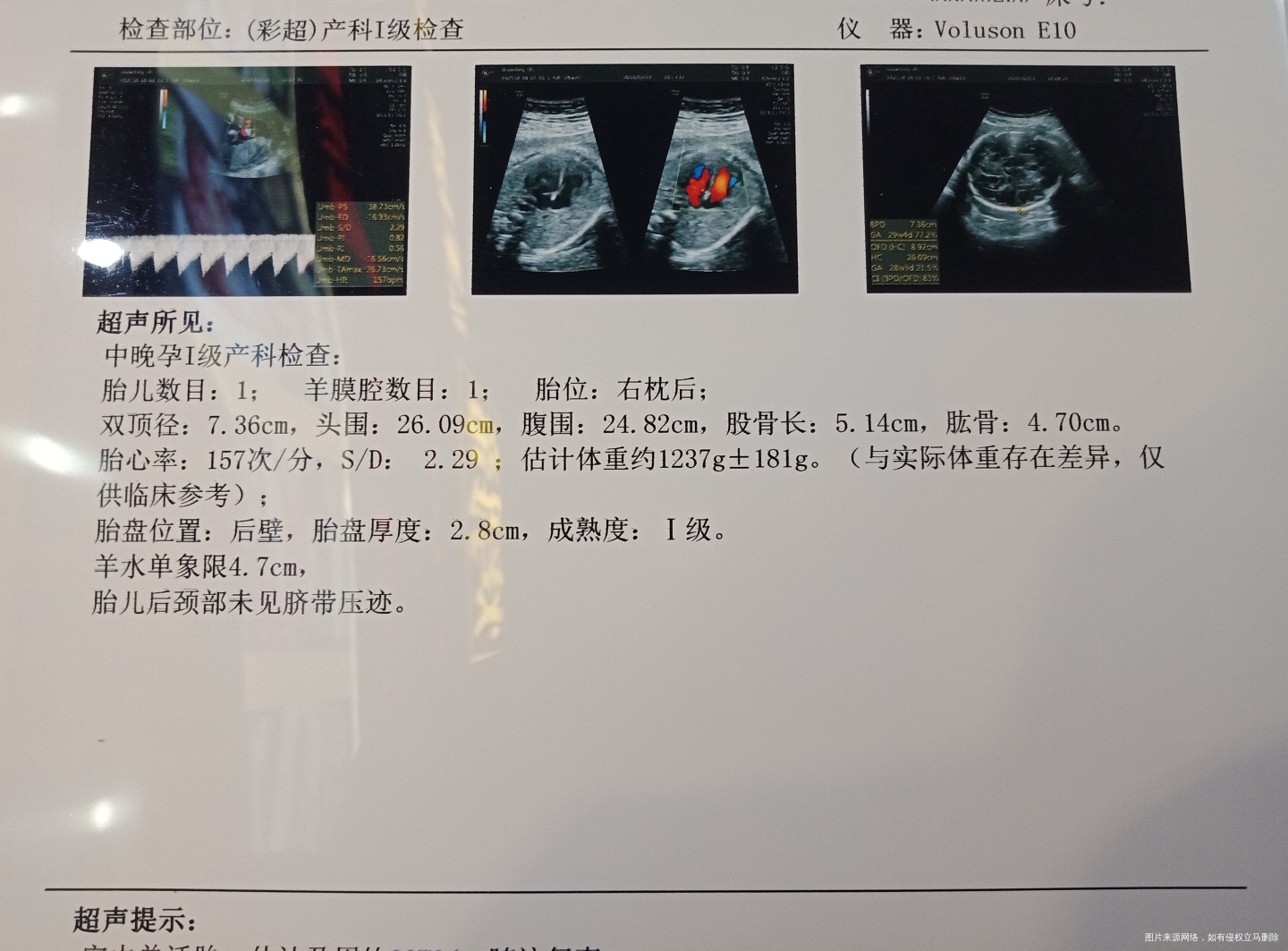 医生帮忙看下检查结果。