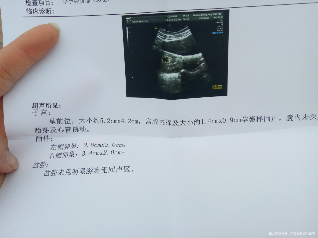 请医生帮忙看看B超结果