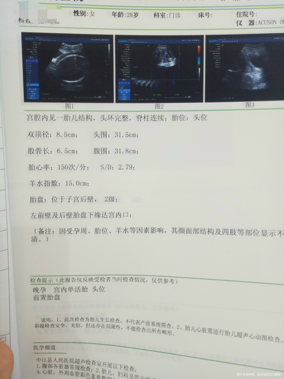 请医生帮我看看宝宝多重了