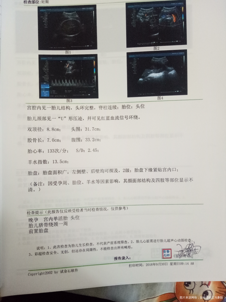 10.4号准备剖腹产请帮忙看看