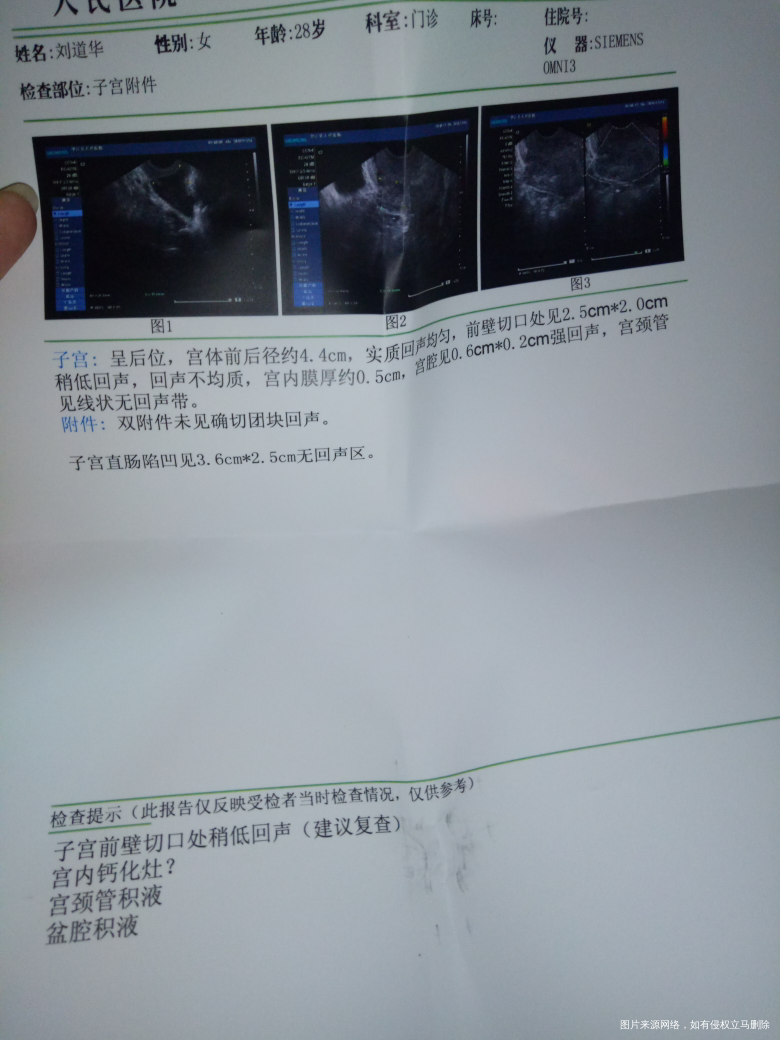 请医生帮忙看一下有问题没有。
