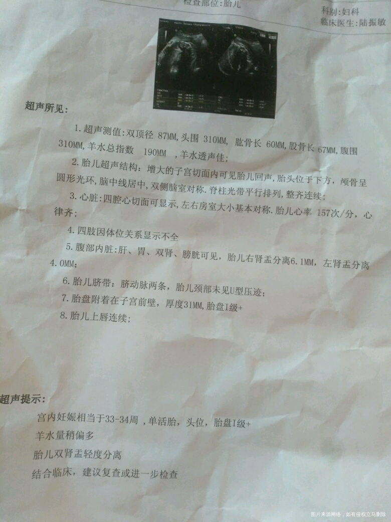 帮忙估下宝宝体重……