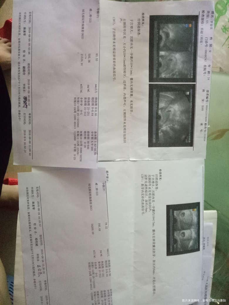 十天了孕囊好像不怎么长大,但有胎心胎芽了,正常吗